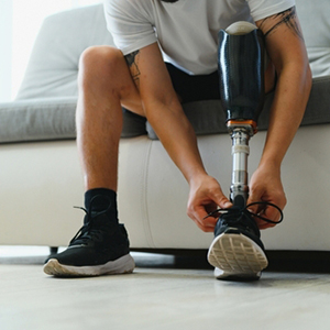 A person with a prosthetic leg tying their shoe, representing SSDI eligibility.