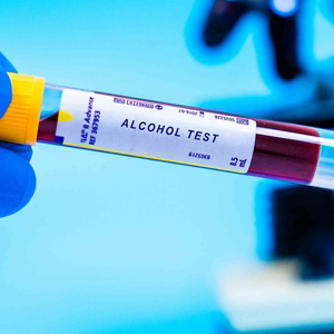 A medical professional holding a blood sample vial for a toxicology screen.