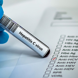 A medical professional holding a blood test vial labeled 
