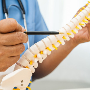 A medical professional pointing to a spinal column model to explain nerve compression