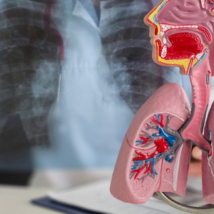 Medical diagram showing the human respiratory system and lung structure for COPD.
