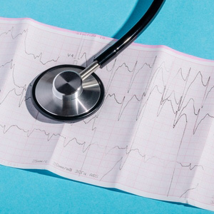 A stethoscope resting on an EKG readout showing heart rhythm patterns for an SSA claim.
