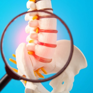 A magnifying glass highlighting inflammation in the facet joints of a spine model.