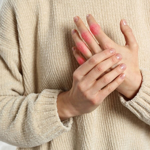 A person holding their painful, inflamed hand joints to represent RA disability.